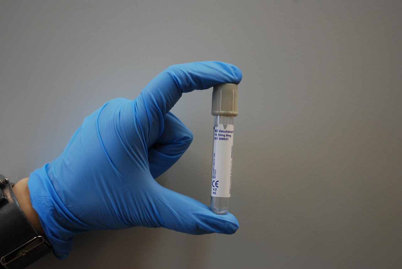 慢性盆腔疼痛最新治療進展研究綜述